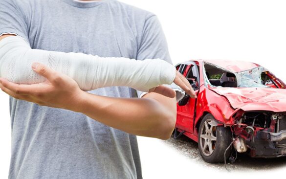 The Toll of Car Accidents - A Look at Severe Injuries